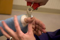 Clinic nurse making adjustments to cast with cutter for patient with a broken wrist.