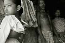 Parents display a growth on their daughters spine in a West Bengal villageBlack and white image.